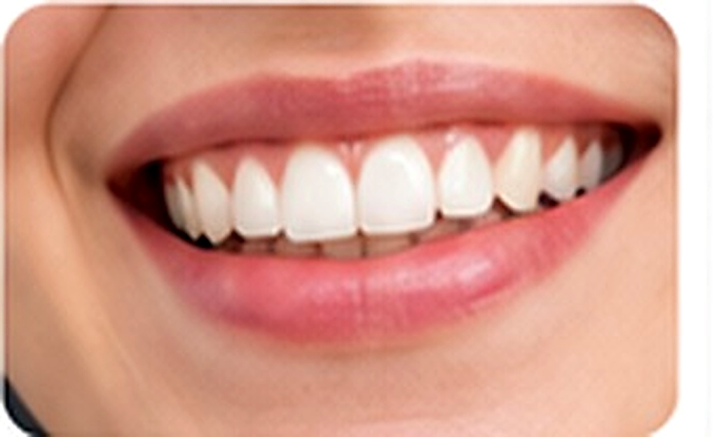 Sorriso saud&aacute;vel ap&oacute;s tratamento est&eacute;tico